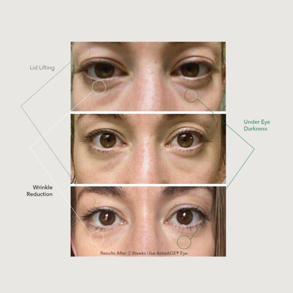 AnteAGE Eye Cream - Image 3