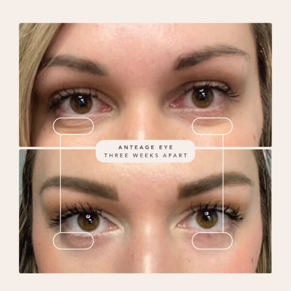 AnteAGE Eye Cream - Image 4